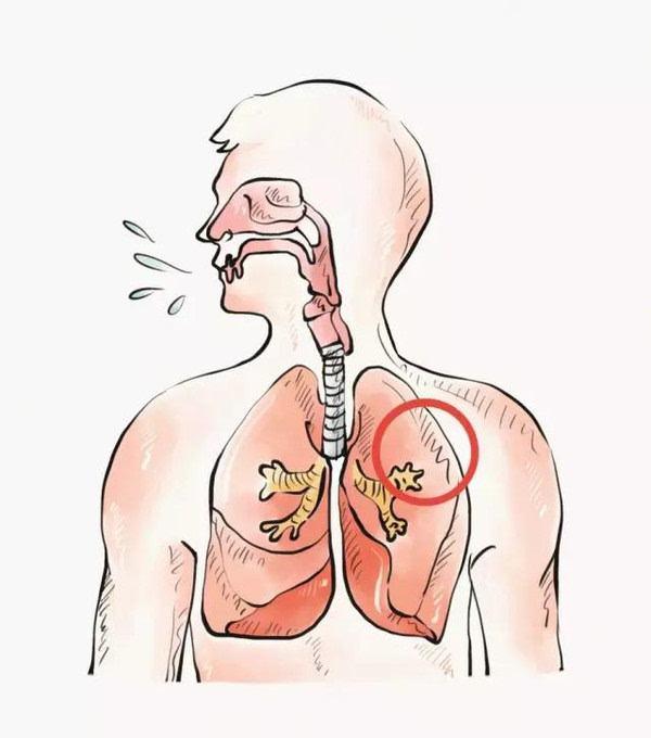 喉咽通过什么与何处相通,喉及声带气管食管解剖关系图