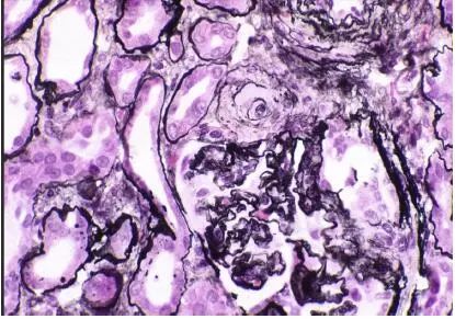 肾毒性的药物排名,肾毒性食物有哪些