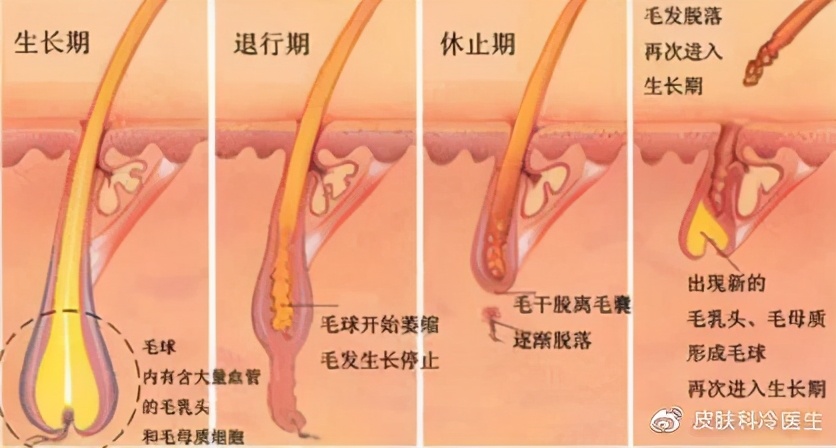 激光祛斑你想知道的都在这儿,关于脱毛的专业知识