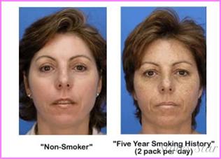 男生如何美白淡斑,男生如何美白补水