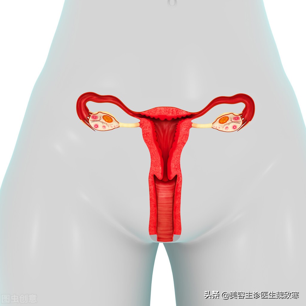 私密整形术后一直出血,私密整形引发肺栓塞