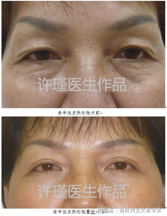 名医专访丨上海交通大学医学院附属同仁医院许瑾：面部美容整形