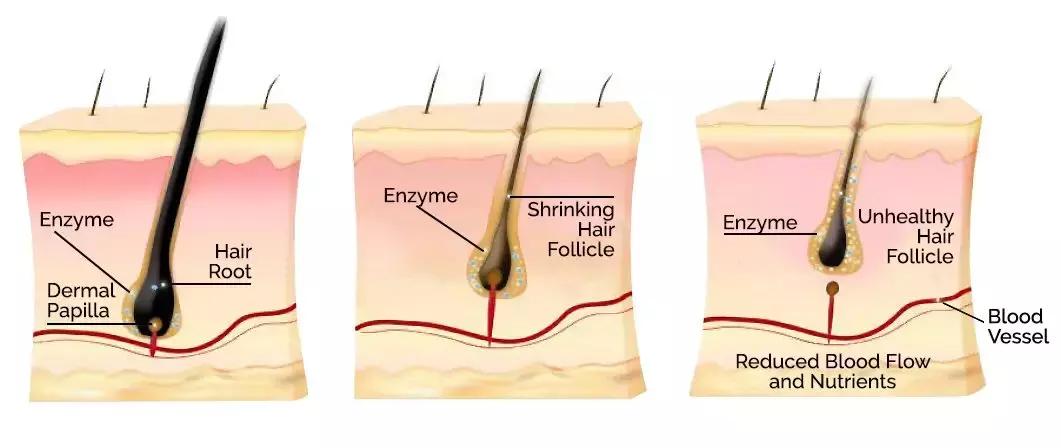 诺奖成果,头发再生最新研究成果