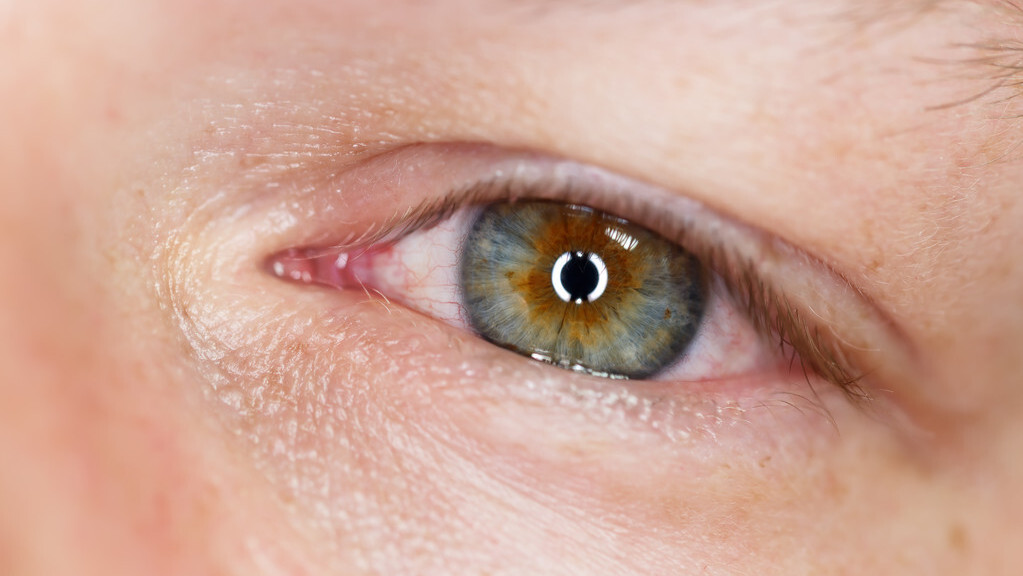 佩戴隐形眼镜眼睛畏光什么原因,佩戴隐形眼镜眼睛刺痛怎么回事