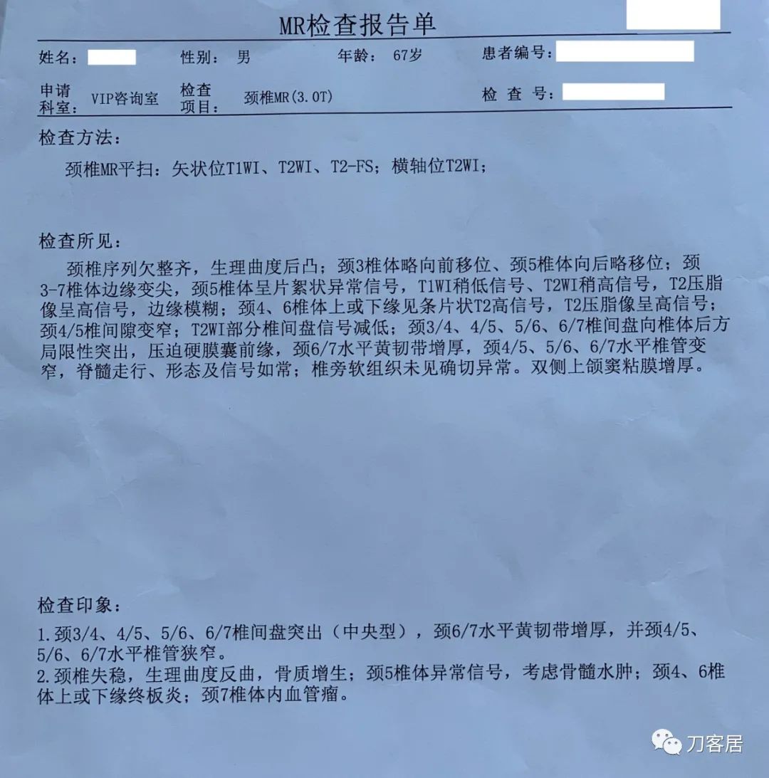 颈椎病椎间盘突出医生说先不手术,颈椎3-7节椎间盘突出怎么治疗