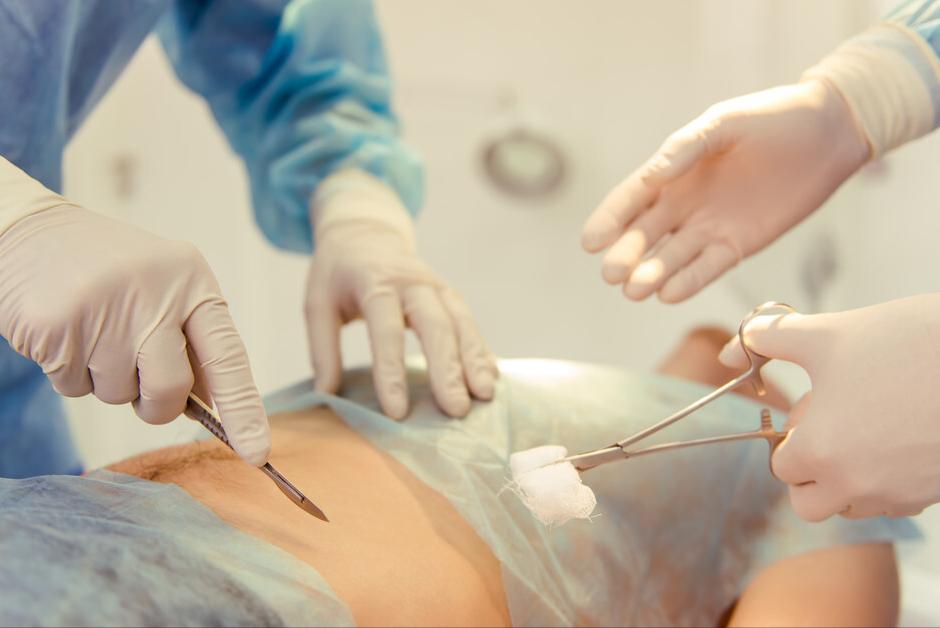 亚急性阑尾炎症状表现有哪些,急性肠胃炎和阑尾炎的症状区别