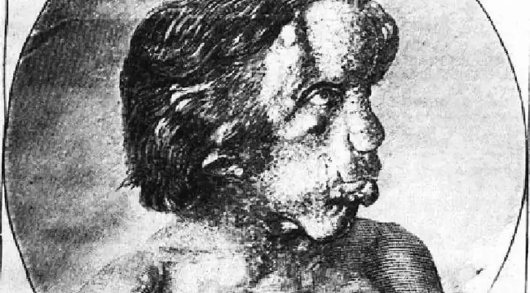 怪病无法直立行走,身患怪病无人能医