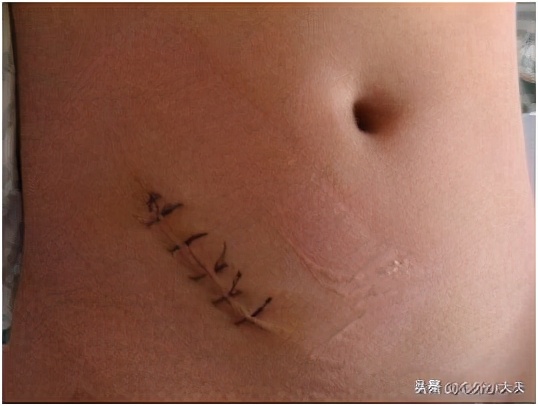 小儿外科常见疾病有哪些,儿童常见的外科疾病有哪些