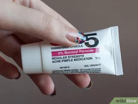 如何去除粉刺闭口,如何去除粉刺最快最有效