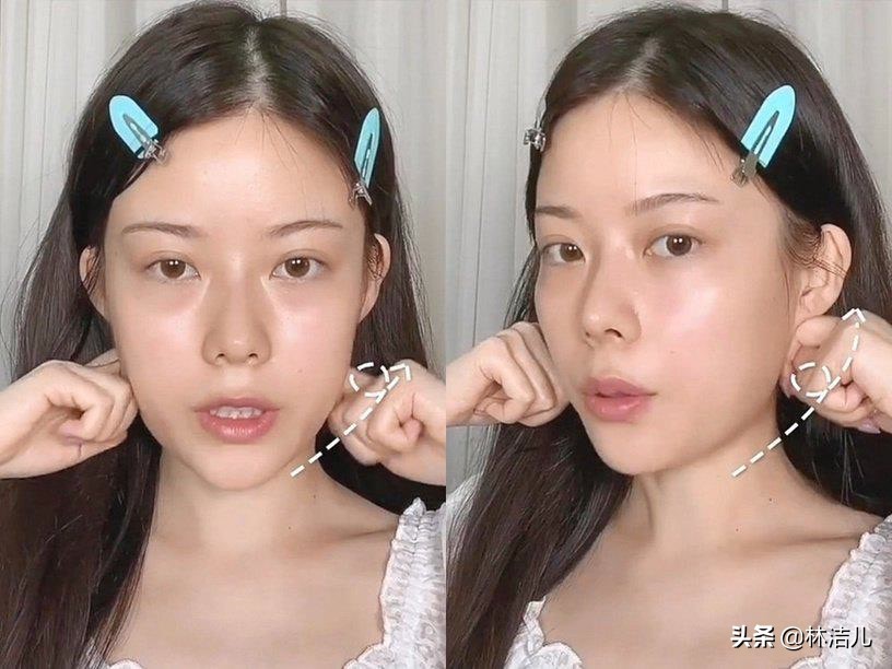 方脸如何变成鹅蛋脸教程,如何将方脸整成高级脸