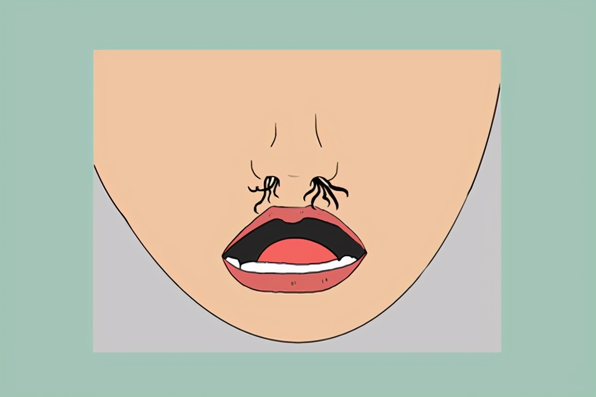 窜出来的鼻毛能剪吗,不小心把鼻毛揪下来会怎么样