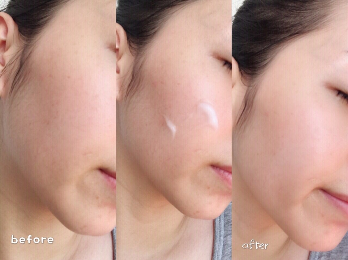 雅诗兰黛智妍面霜适合夏天用吗,兰蔻菁纯面霜滋润版夏天能用吗