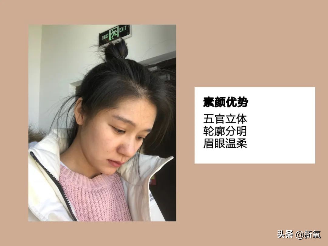 村姑整成鞠婧祎的鼻子变天使,鞠婧祎的鼻子整过吗