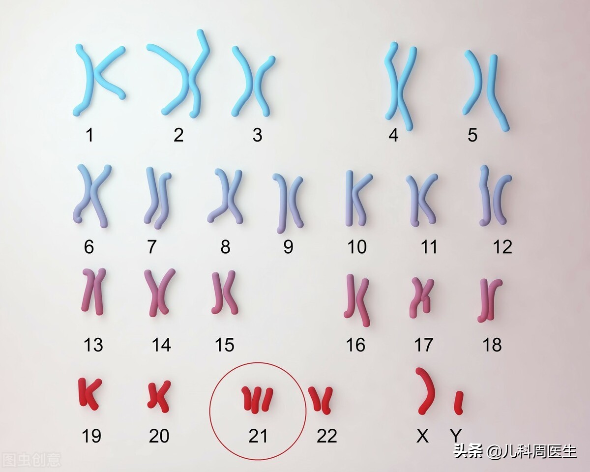 高龄唐筛21三体临界风险有没有事,唐筛21三体综合征会不会误诊