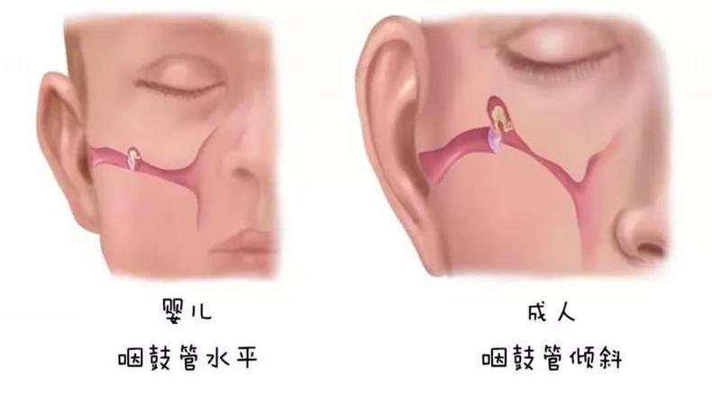 宝宝频繁挠耳朵耳朵口有红肿,宝宝总挠耳朵是要长牙了吗