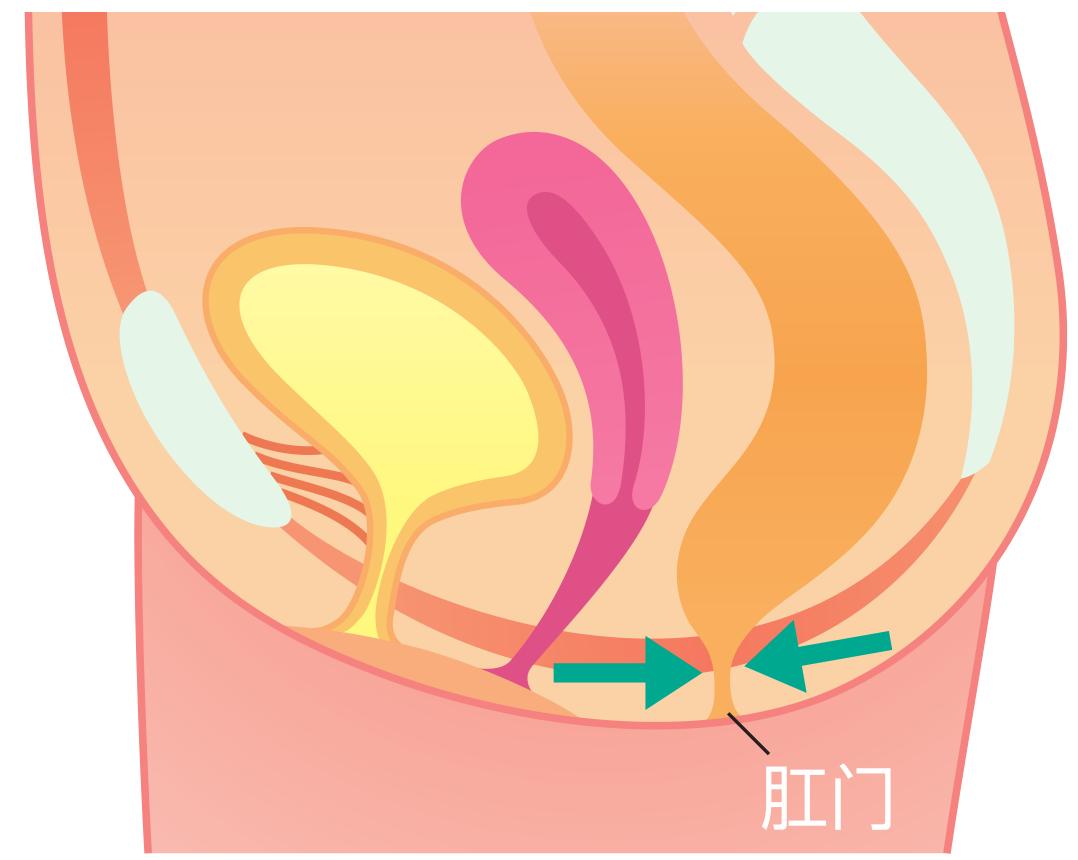 盆底肌训练器材可以改善漏尿吗,改善盆底肌漏尿