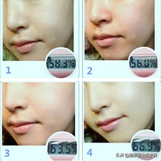 在脸上扎几百万个洞的“水光针”，效果到底怎样？