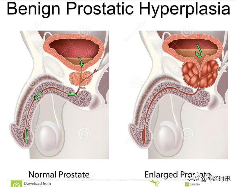 肾脏输尿管膀胱前列腺结构,肾输尿管膀胱解剖示意图
