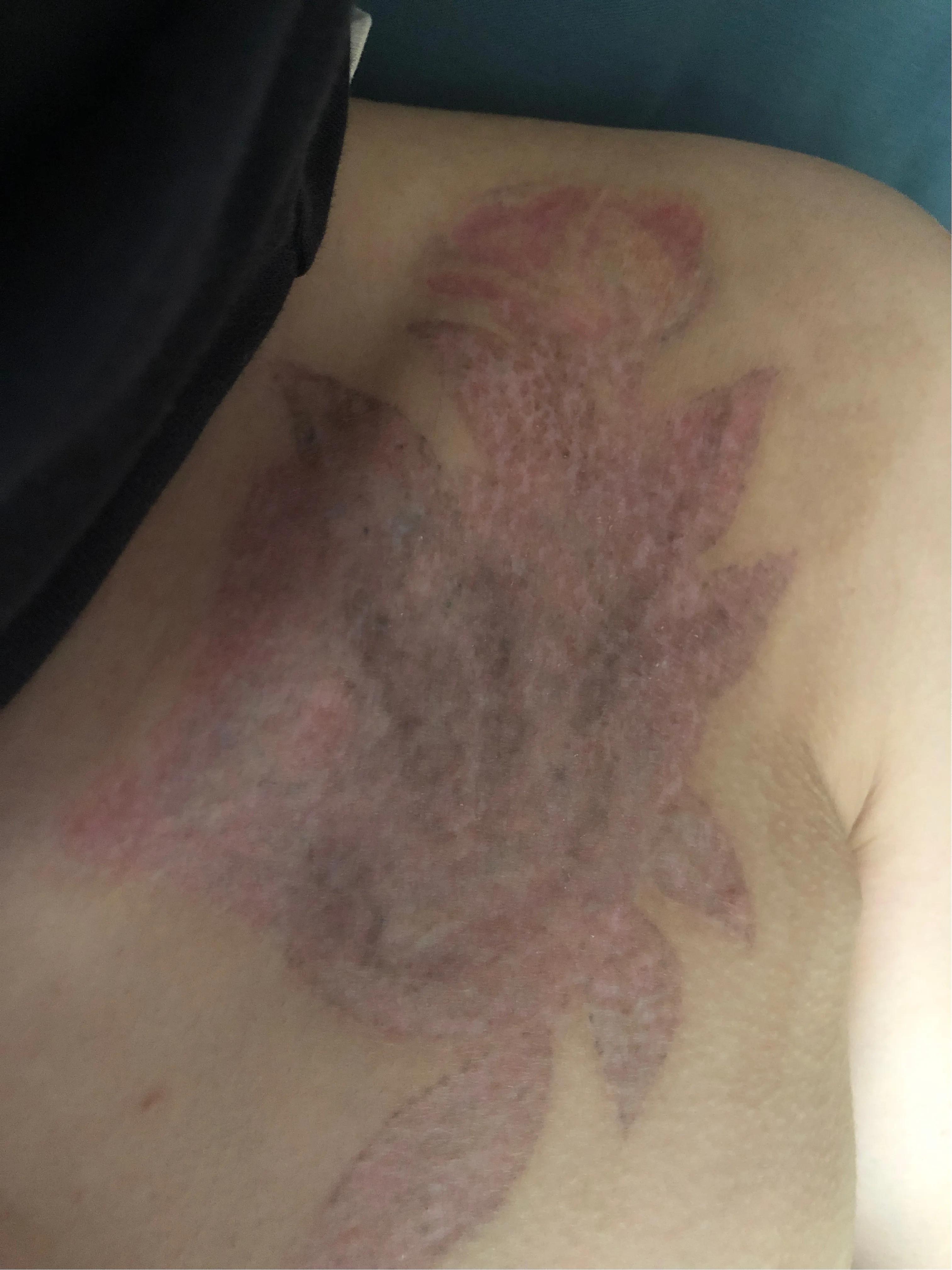 洗纹身到底能不能洗干净,洗纹身能不能彻底洗干净