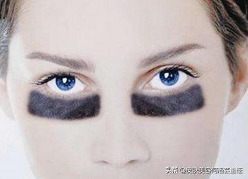 熬夜怎么快速去除黑眼圈,熬夜怎么消除黑眼圈学生党