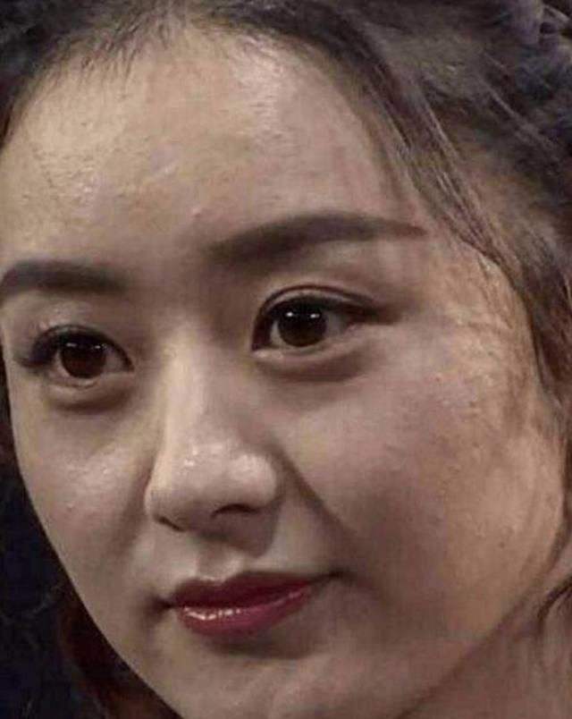 赵丽颖皮肤毛孔粗大图片,赵丽颖无美颜无滤镜最真实的模样