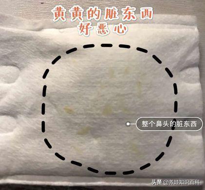 天天熬夜带娃瘦了,天天熬夜带娃也不见瘦