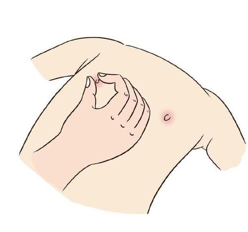 新生儿乳头该不该挤？又该怎么好好护理？别在用无知伤害孩子了