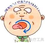 吞咽功能障碍康复训练手法,吞咽功能障碍传统康复治疗方法