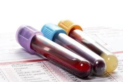 细菌感染和病毒感染的血常规指标,血常规有些指标高一点点要不要紧