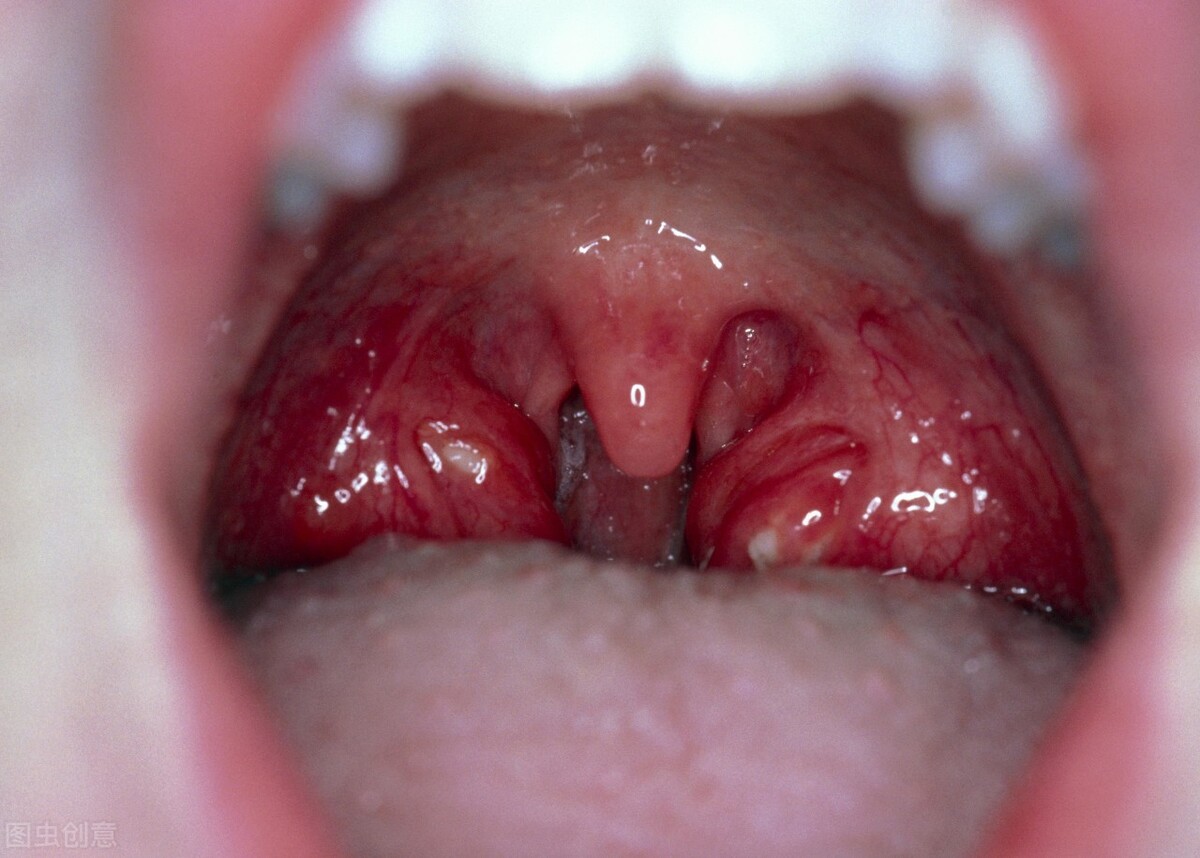 血常规炎症主要看什么指标,免疫治疗血常规