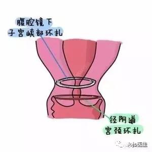 网红殴打孕妇的危害,网红暴打孕妇致先兆流产后再道歉