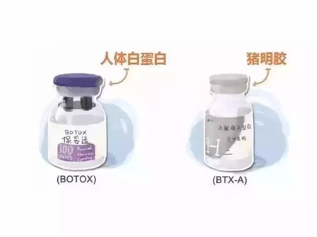 国产跟进口的瘦脸针的区别,国产瘦脸针跟进口的有啥区别