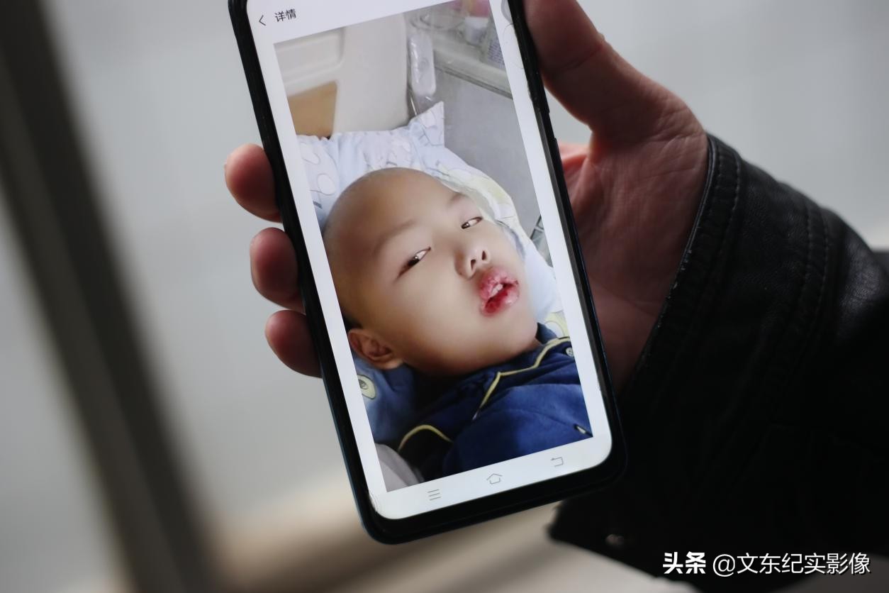 川崎病引发白血病,川崎病男孩得白血病