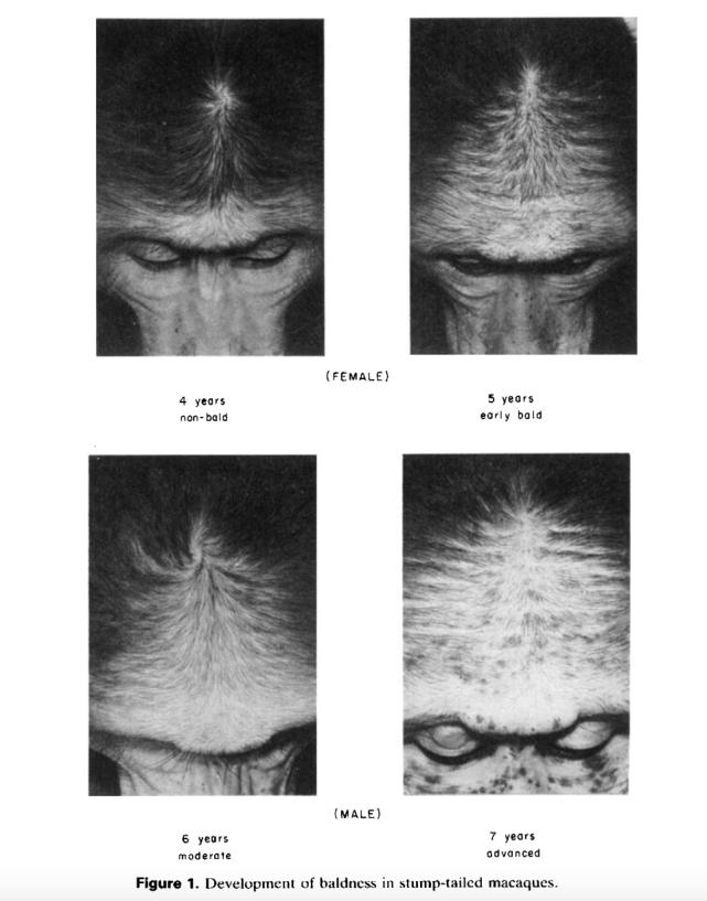 脱发真的无法遏制吗,脱发能拯救吗