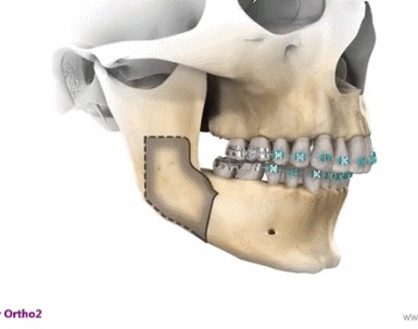好看的侧脸要符合哪些条件,好看的侧脸的标准