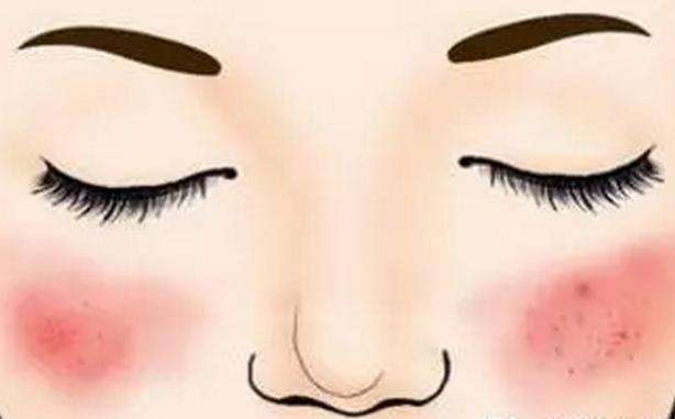 如何预防化妆品引发的皮肤病 (化妆品引起的皮肤病涂什么药好)