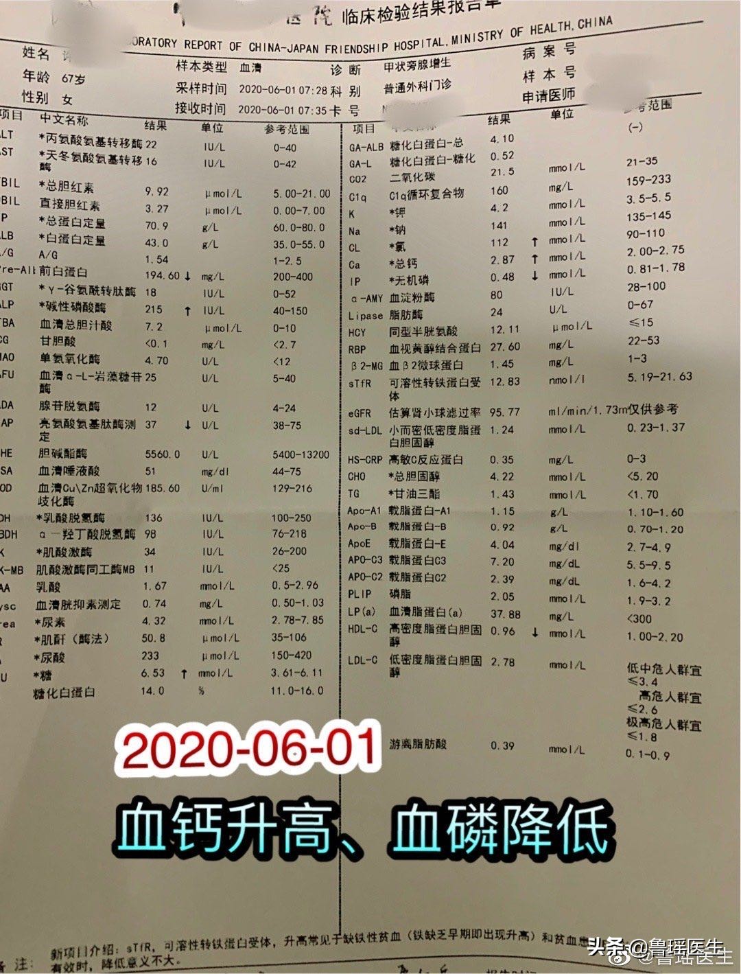 原发性甲旁亢临床症状,原发性甲旁亢为何多尿