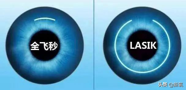 杨超越的眼睛大而无神,杨超越眼神空洞