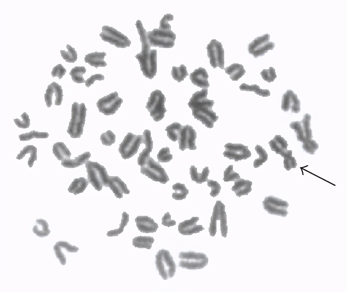 dna断裂会发生什么,人类dna断裂会怎样