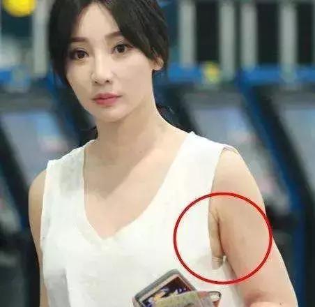 超模消除副乳,超模收副乳