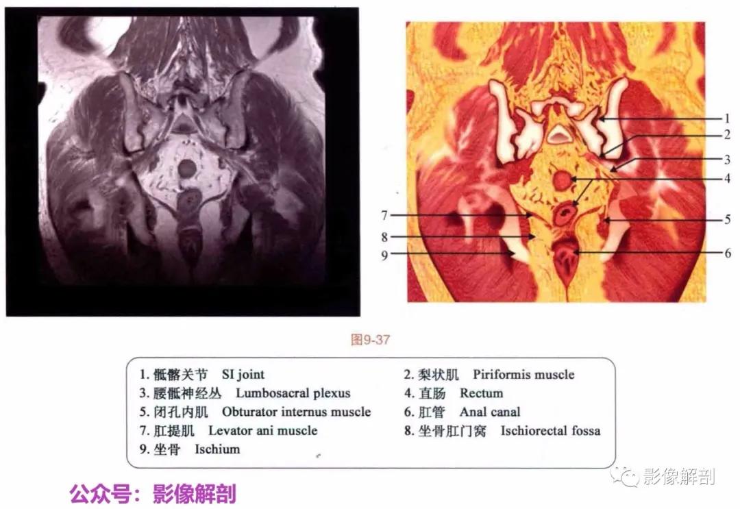女性盆腔矢状位断层解剖,男性盆腔磁共振断层图谱