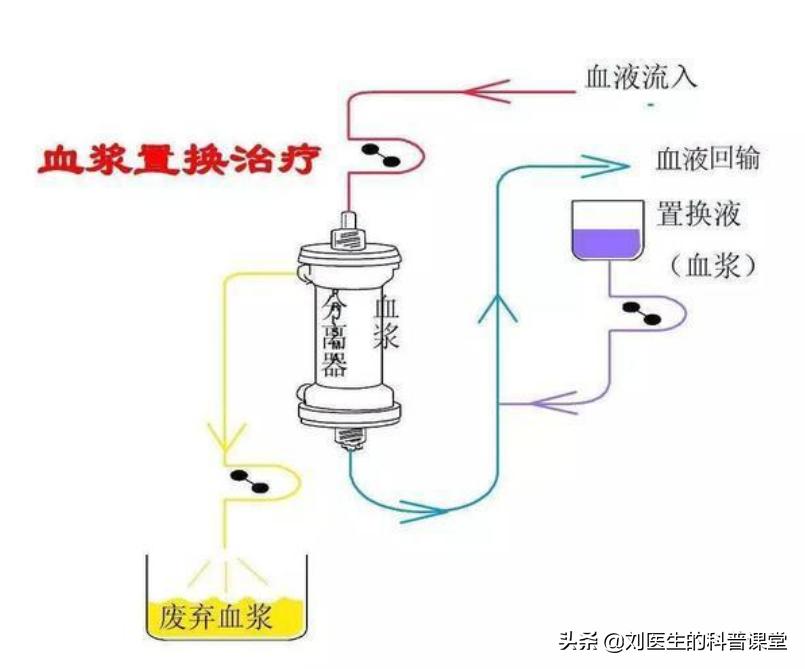 重症人工肝,人工肝的治疗指征
