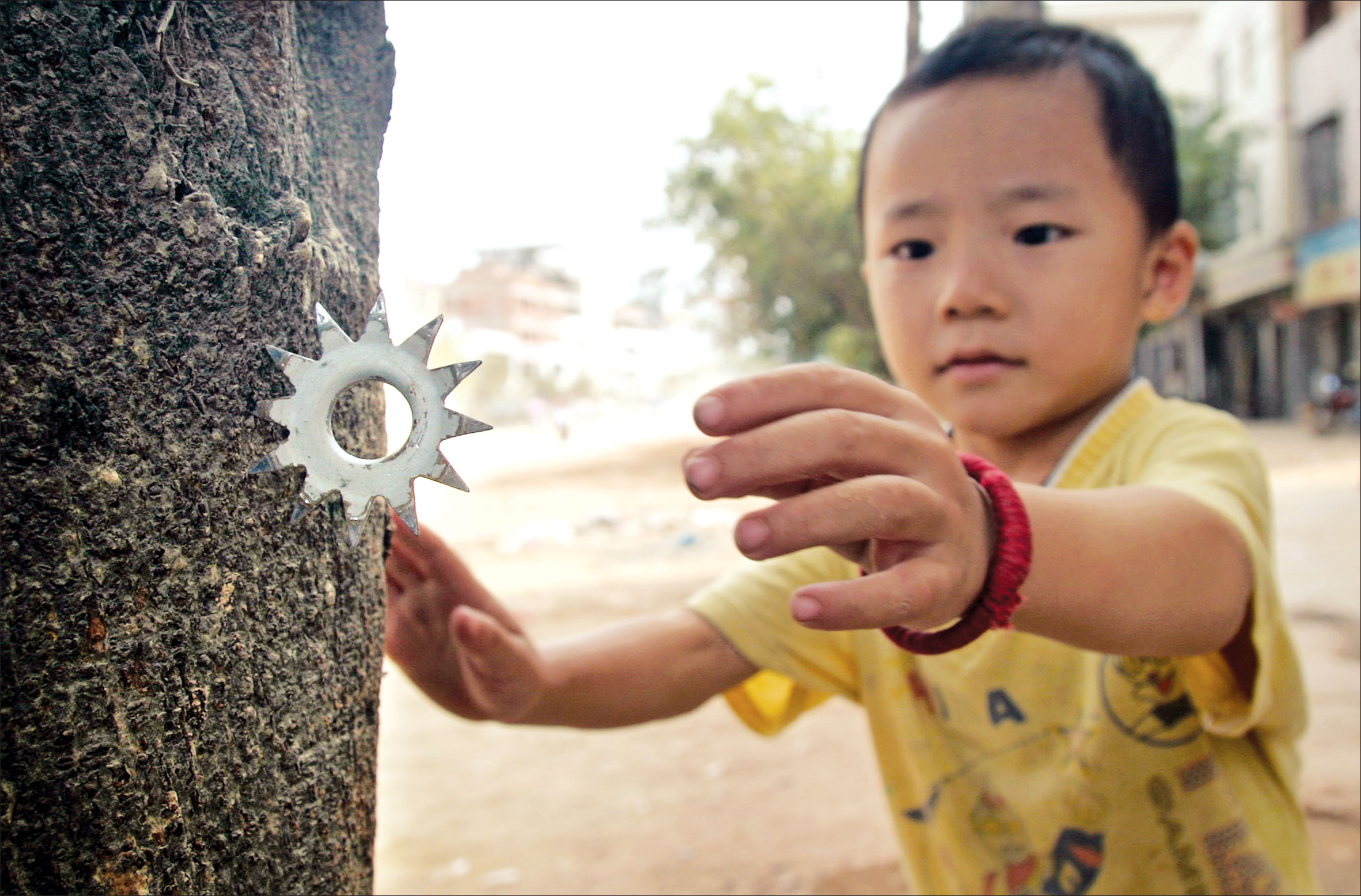 男孩玩闹时不慎戳到同学眼睛,课间男孩眼睛被同学戳伤