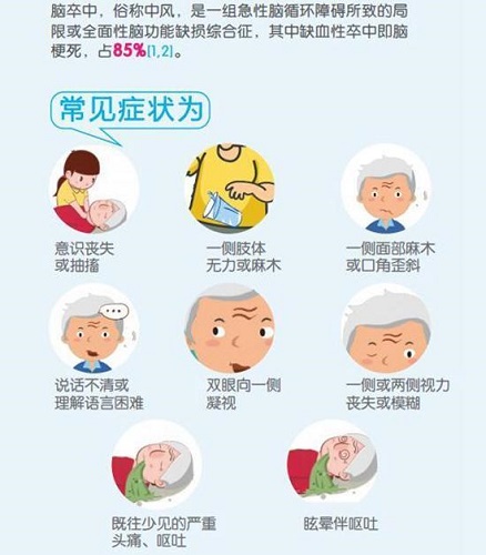 脑中风前期征兆有哪些,脑中风的十个高危因素