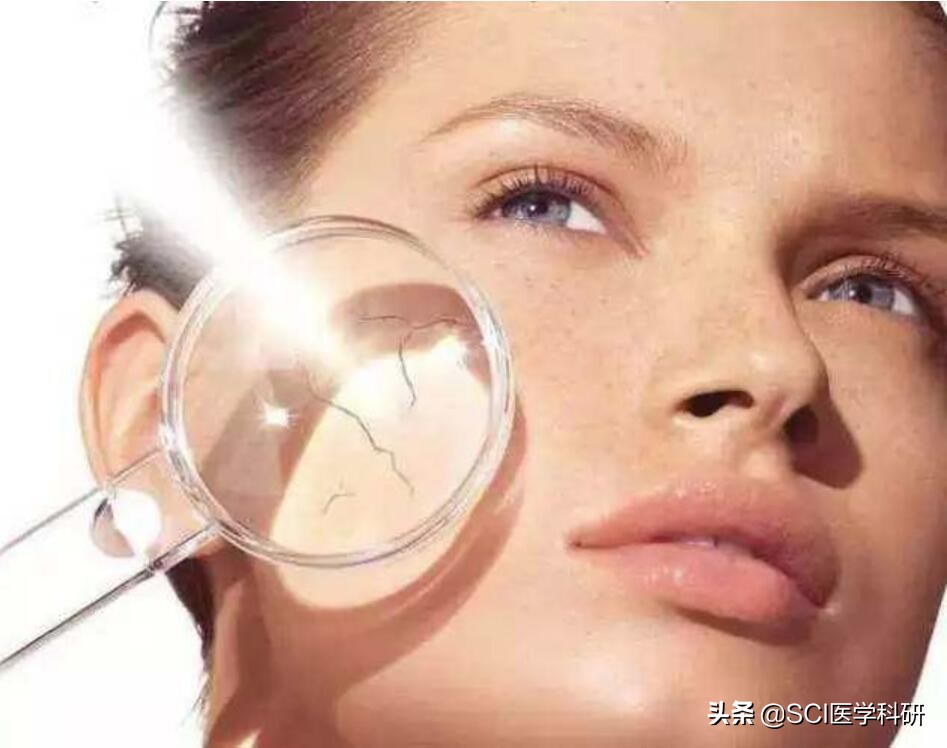 女子割双眼皮变白眉大侠,一女子割双眼皮变白