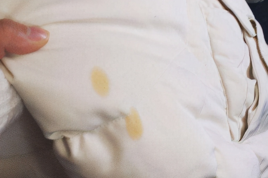 羽绒服发黄没有白醋怎么洗,羽绒服发黄污渍怎么去除