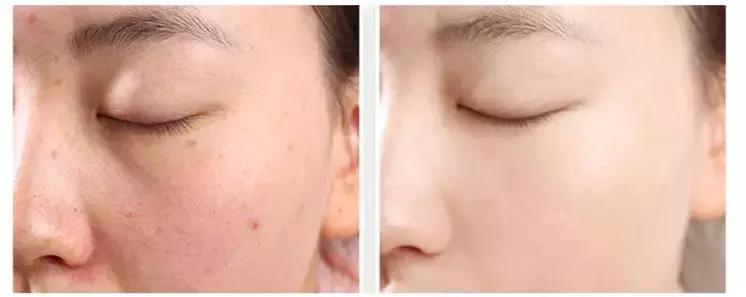 10款热门气垫,圣罗兰气垫适合干皮还是油皮