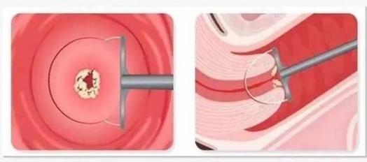 妇科疾病那些你不知道的谣传,其实一般的妇科病都是可以治愈的