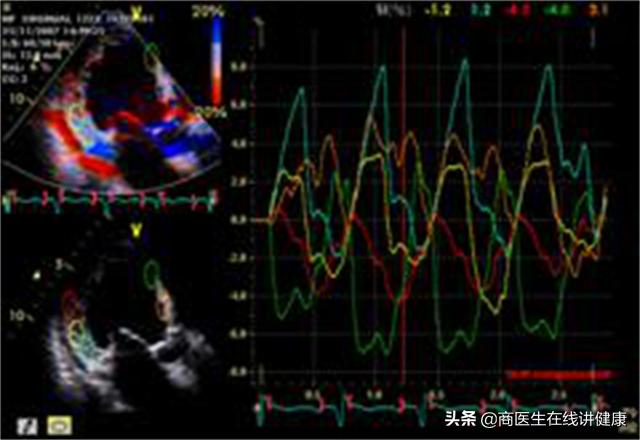 心脏病说犯就犯吃什么中药,冠心病心绞痛长期吃丹参片有效吗