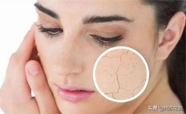 大干皮起皮怎么办,脸上干皮起皮怎么办